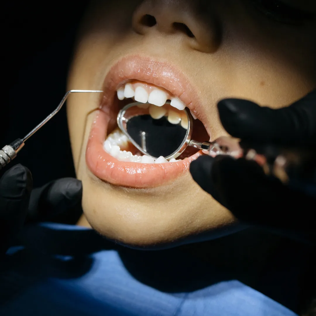 Dental crowns specialist