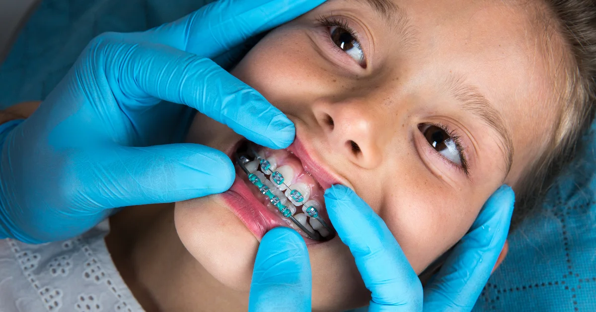 Should your child see an orthodontist arcadia