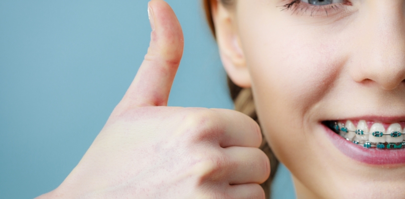 Affordable braces for adults