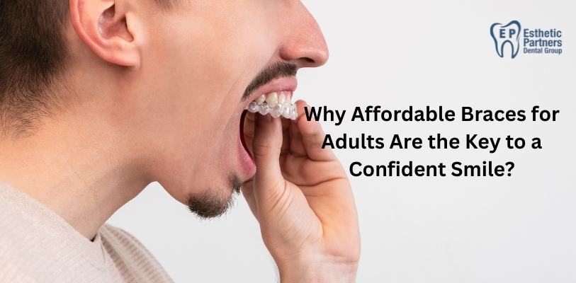 affordable braces for adults